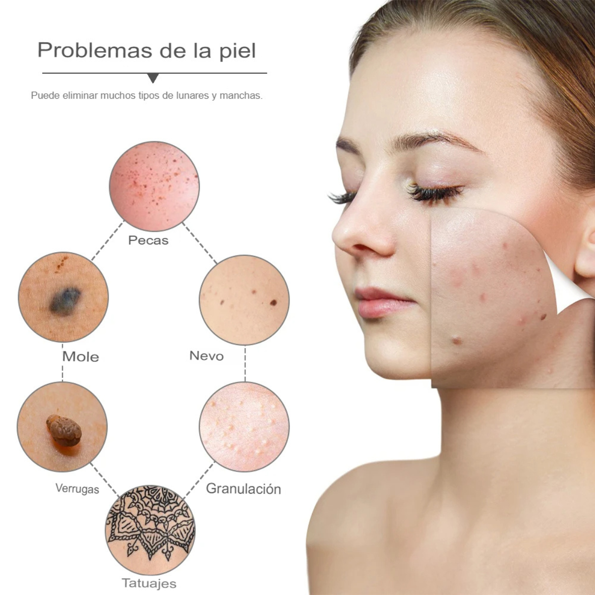 Plasma Pen para un Lifting Facial - Imagen 3